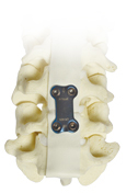 Orthopedic Implants, Orthopedic Instruments, Maxillofacial Implants ...